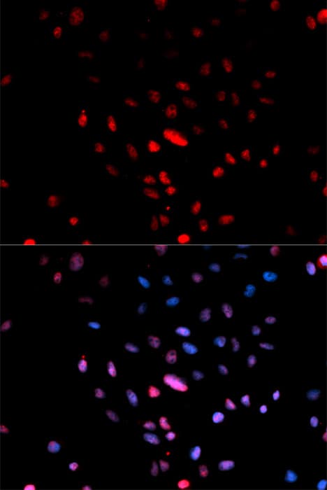 JUN / c-Jun Antibody (phospho-Ser73)