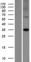ELOVL7 Protein (Over-Expression Lysate Myc-DDK (Flag))