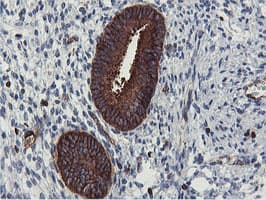 PFKP Antibody (clone OTI1A11)