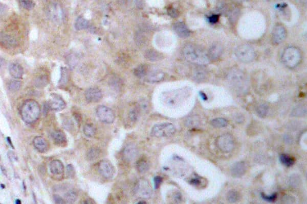 KDR / VEGFR2 / FLK1 Antibody (Asp1209)