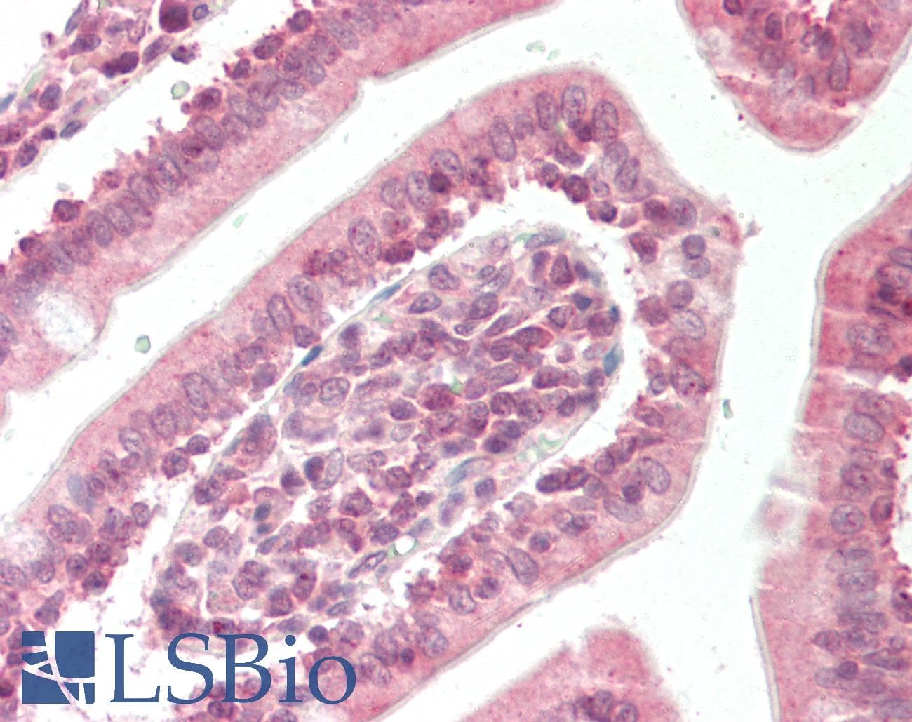 Polyclonal Rabbit anti-Human RELA / NFKB p65 Antibody (C-Terminus, IHC, WB)