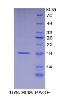 Human LAMA1 / Laminin Alpha 1 Protein (Recombinant His)
