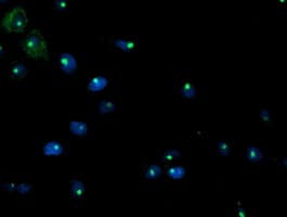 PGAM2 Antibody (clone OTI1C11, Carrier-free)