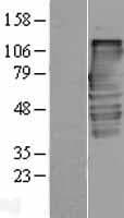 TXLNA / Alpha Taxilin Protein (Over-Expression Lysate Myc-DDK (Flag))