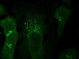 IHC-plus™ TGN46 / TGN38 Antibody (aa200-350)