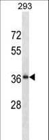 RALYL Antibody (aa76-104)