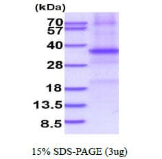 Human SFRP5 Protein (Recombinant His)