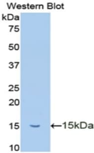 TFF2 / SP Antibody (aa25-127)