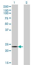 CITED4 Antibody (clone 4F6)