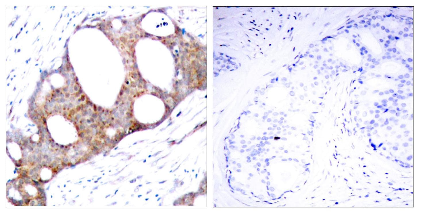 GSK3A / GSK3 Alpha Antibody (phospho-Ser21)