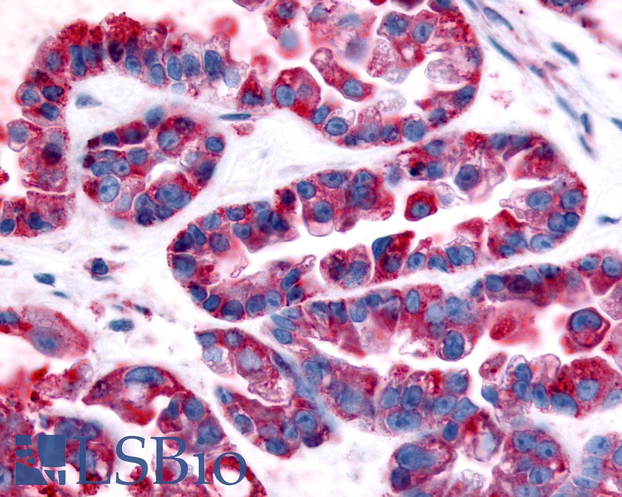 PathPlus™ GPR32 Antibody (Extracellular Domain)