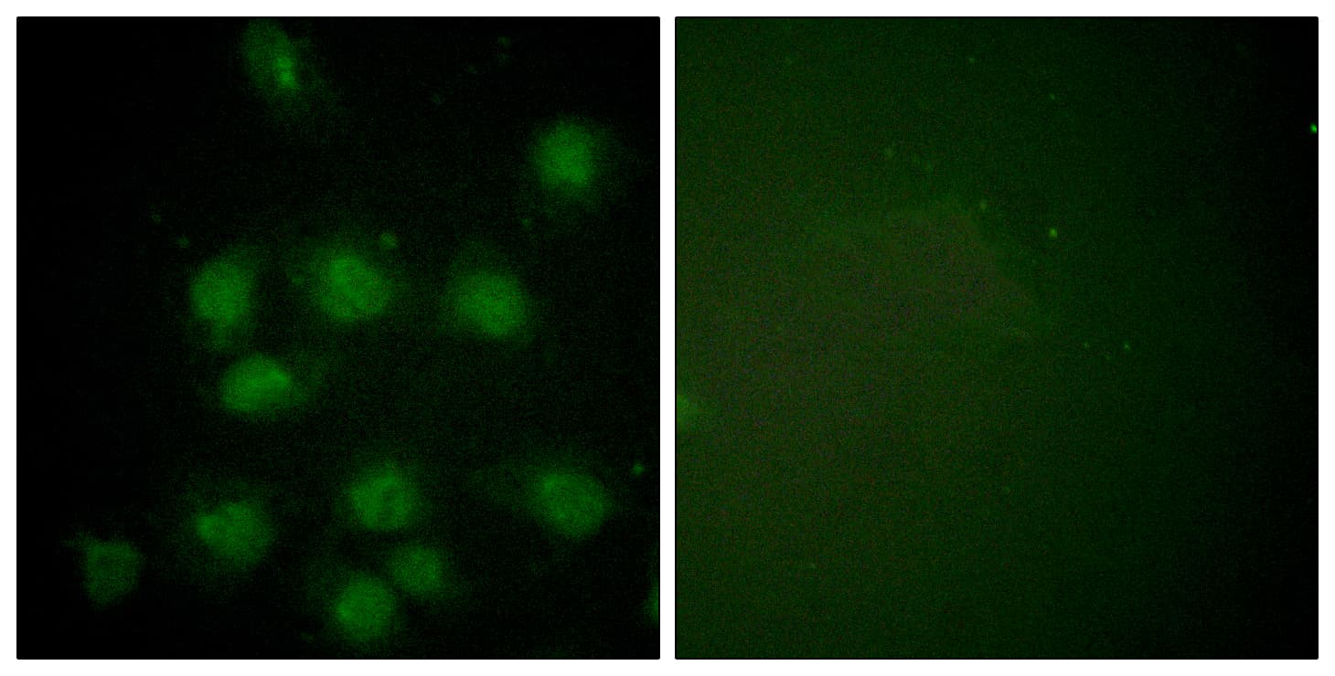NIFK / MKI67IP Antibody (phospho-Thr234)