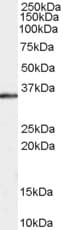 IHC-plus™ STUB1 / CHIP Antibody (aa219-231)