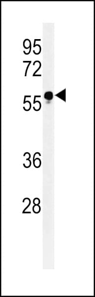 Polyclonal Rabbit anti-Human FUT6 Antibody (aa102-130, IHC, WB)