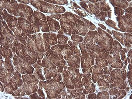 MAP2K1 / MKK1 / MEK1 Antibody (clone OTI2A9)