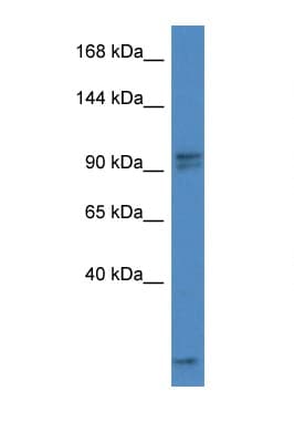 AAK1 Antibody (aa593-642)