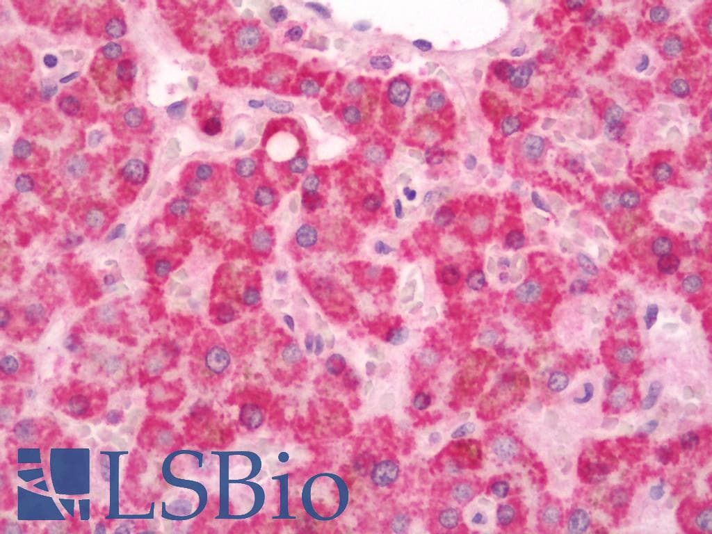 IHC-plus™ SDR9C1 / BDH1 Antibody (aa47-343)