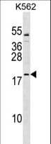 Polyclonal Rabbit anti-Human TCF15 / PARAXIS Antibody (aa81-107, WB)