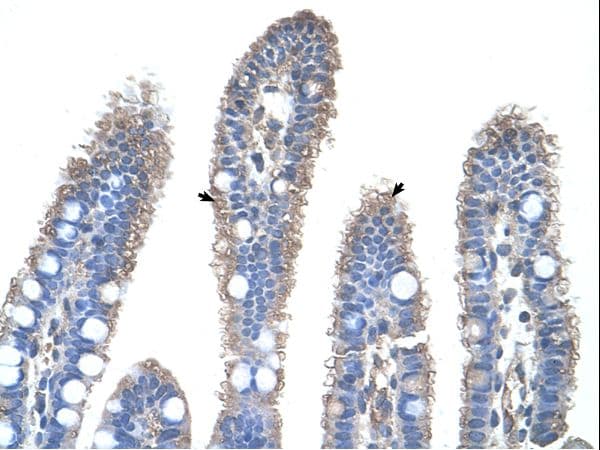 OTC Antibody (N-Terminus)