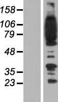 ADAP / FYB Protein (Over-Expression Lysate Myc-DDK (Flag))