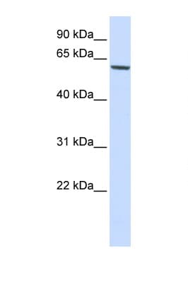 FOXO4 / AFX1 Antibody (aa108-157)