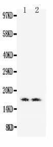 Polyclonal Rabbit anti-Human MB / Myoglobin Antibody (aa138-154, WB)