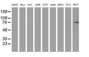 PFKP Antibody (clone OTI1F2)