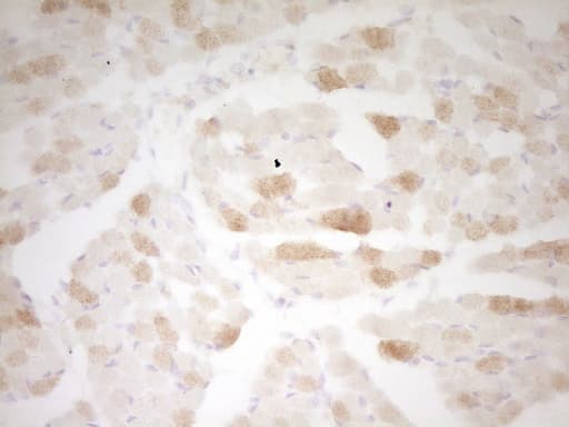 TNNI3 / Cardiac Troponin I Antibody (clone OTI14A2)
