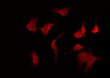 GPR160 Antibody