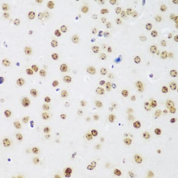 MECP2 Antibody