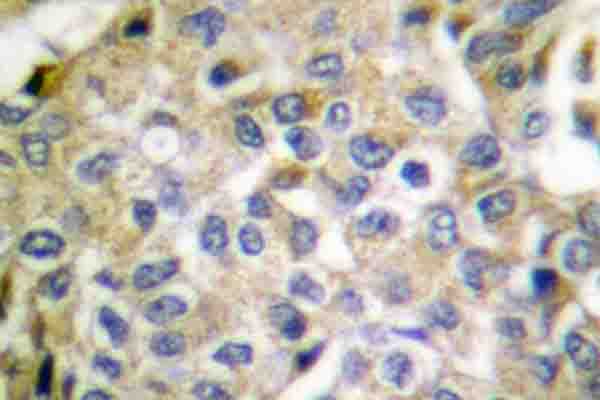 SMAD1 Antibody (Pro457)