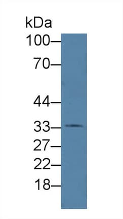 HFE2 / Hemojuvelin Antibody (aa29-401)