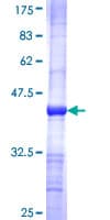 Human GUCY1A2 Protein (Recombinant GST, N-terminus)