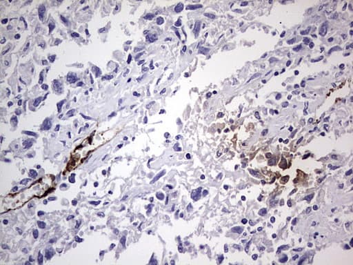 VWF / Von Willebrand Factor Antibody (aa764-1263, clone OTI6C7)