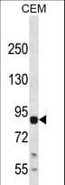 MAP3K13 / LZK Antibody (Ser869)