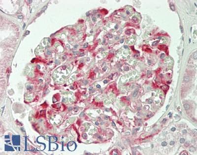 IHC-plus™ SLC28A2 Antibody (Internal)