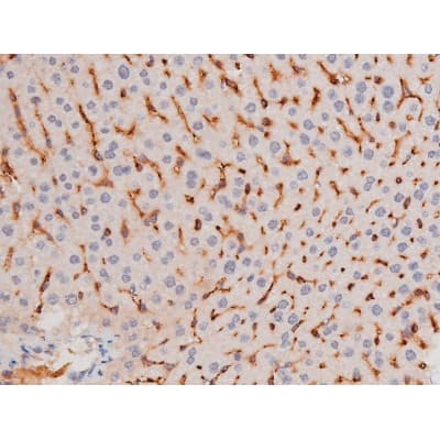 ADD1 / Adducin Alpha Antibody (phospho-Ser726)