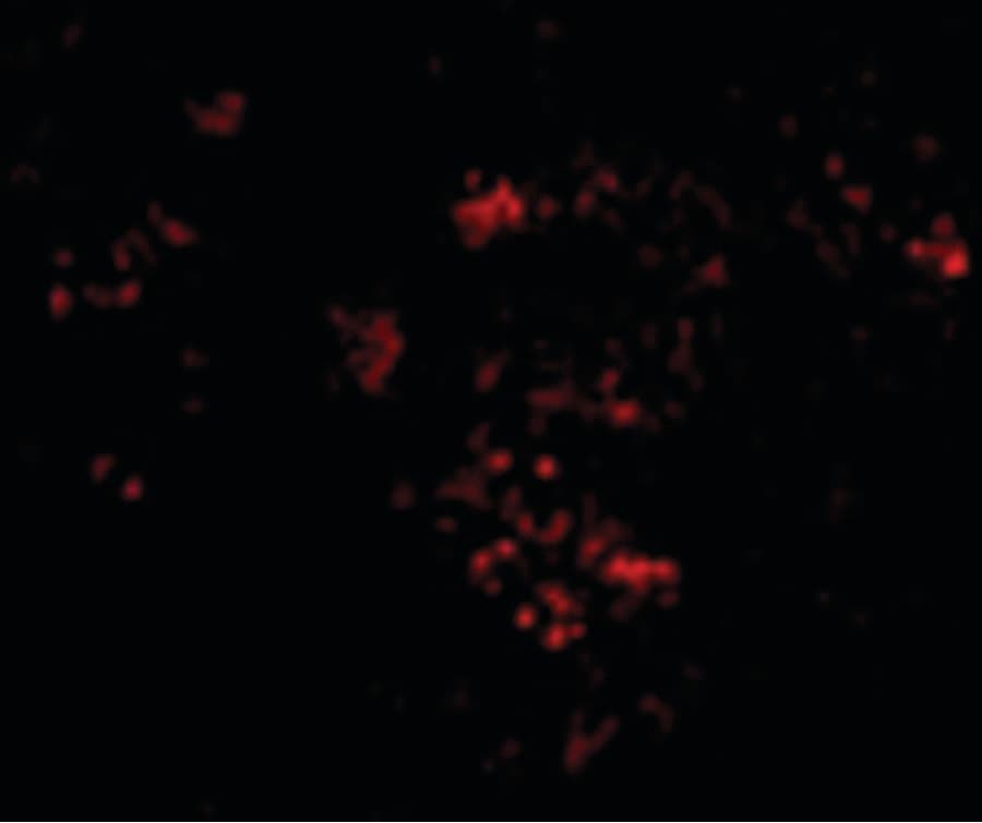 IHC-plus™ PAK2 Antibody