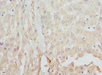 Polyclonal Rabbit anti-Human FCN1 / Ficolin-1 Antibody (IHC)