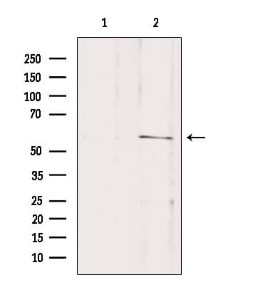 Polyclonal Rabbit anti-Human SLC16A2 / MCT8 Antibody (IF, WB)