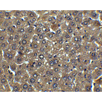 Polyclonal Chicken anti-Human ALB / Serum Albumin Antibody (IHC, IF, WB)