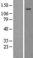 THBS2 / Thrombospondin 2 Protein (Over-Expression Lysate Myc-DDK (Flag))