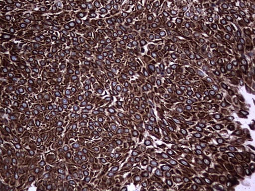 Monoclonal Mouse anti-Human CCL19 / MIP3-Beta Antibody (clone OTI2A12, aa22-98, IHC)