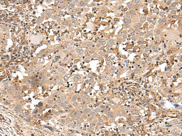 FSTL5 Antibody
