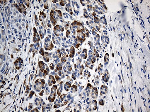 GIPC1 / GIPC Antibody (clone OTI6A6)
