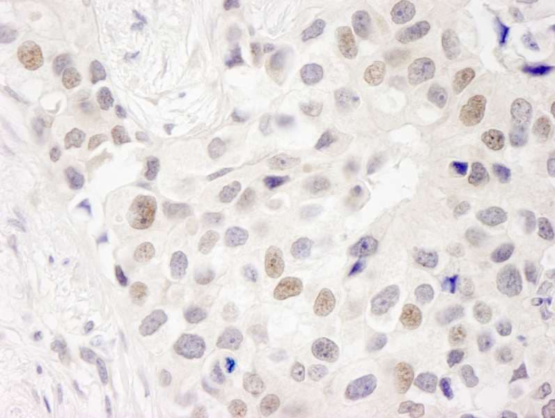 Polyclonal Rabbit anti-Human INT7 / INTS7 Antibody (aa850-900, IHC)