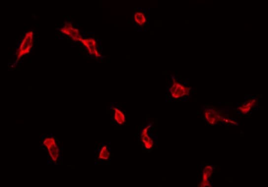 ZDHHC9 Antibody