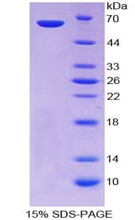 Mouse CENPI / CENP-I Protein (Recombinant His-GST)