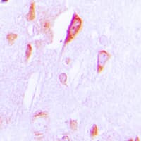 Polyclonal Rabbit anti-Human Cytochrome P450 CYP1A1/2 Antibody (Internal, IHC, IF, WB)