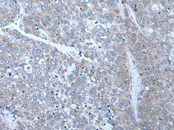 SLC24A5 / NCKX5 Antibody